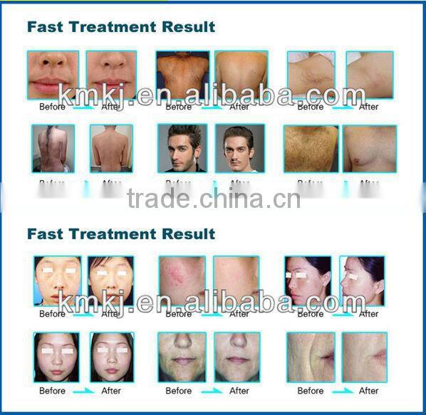 Hot selling Safety ultra lipo cavitation rf beauty slimming machine