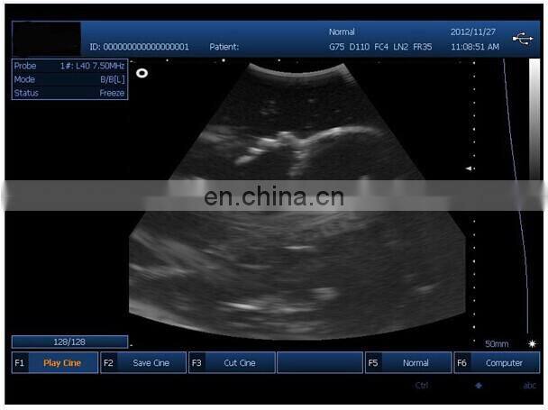 HC-A006A15 Inch Portable Black and White Ultrasound buy ultrasound scanner machines
