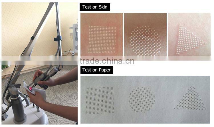 High energy rf tube vaginal rejuvenation rf co2 fractional laser machine