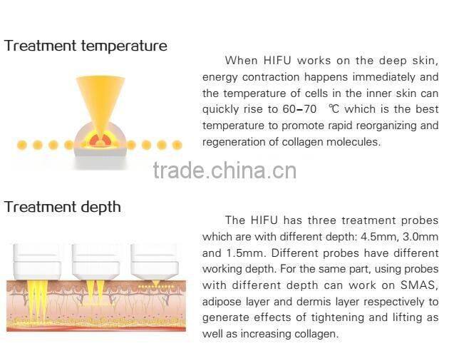 hifu high intensity focused ultrasound / hifu portable / hifu 2015