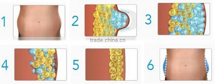 2016 professional Hot sell high quality cryotherapy body slimming machine