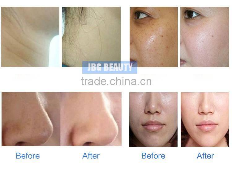 Factory hot sale no needle mesotherapy bipolar rf skin care machine with galvanic skin lifting