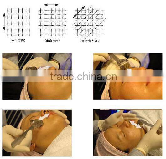 600 Needles golden Body Dermaroller