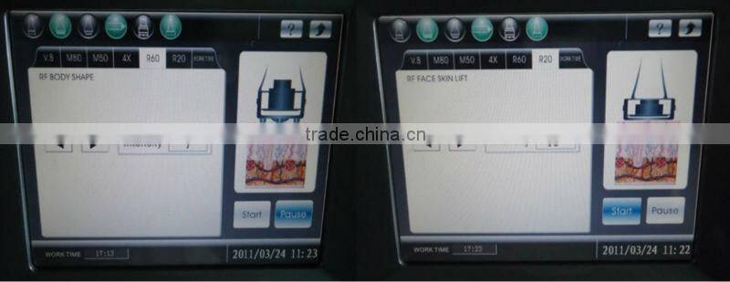 Cavitation RF Ultrasonic Vacuum Machine S80C ISO/CE Liposlim Cavitation Machine