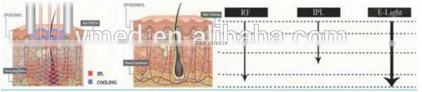 2 size handles !! IPL Hair Removal Wrinkle Removal E-light Technology RF Machine