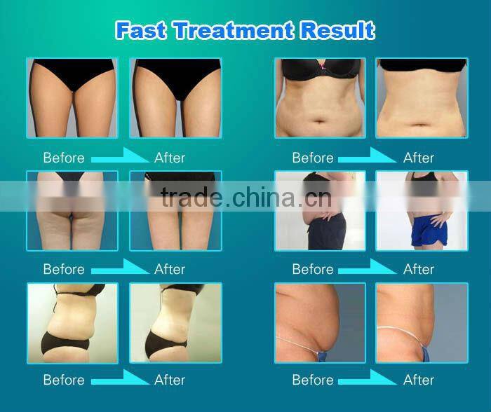 ultrasound cavitation body contouring machine
