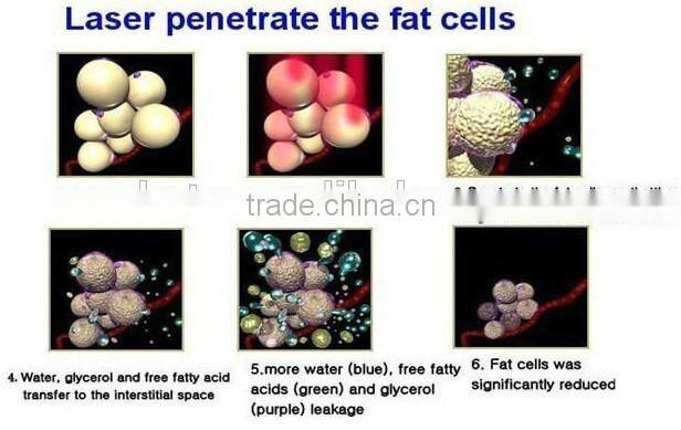 2015 portable lipo laser lipolysis slimming machine