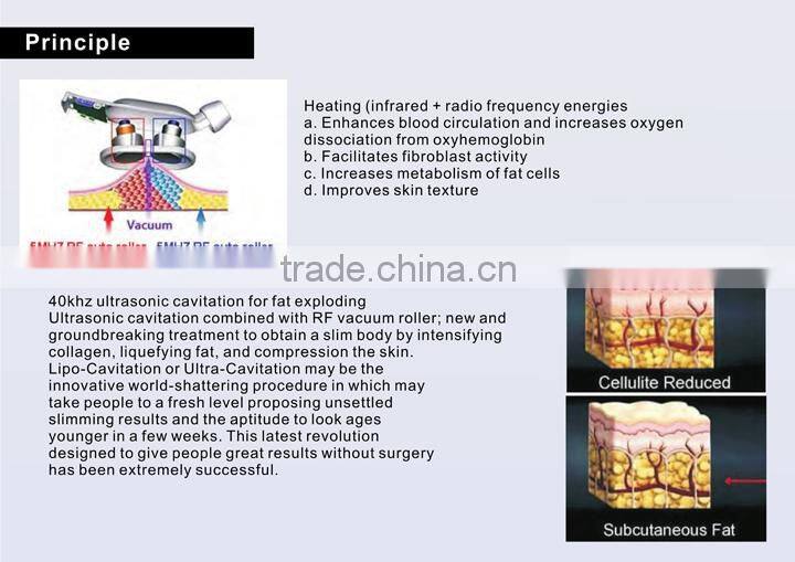 Hot sale Skin tighten and body slimming machine