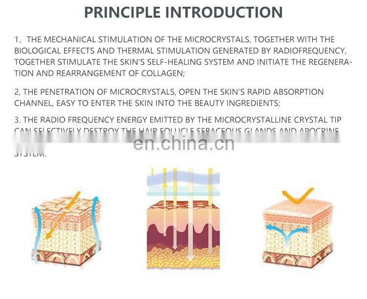 Renlang Microcrystal Technology RF Insulation Microneedle Acne Removal Cold Hammer Skin Care