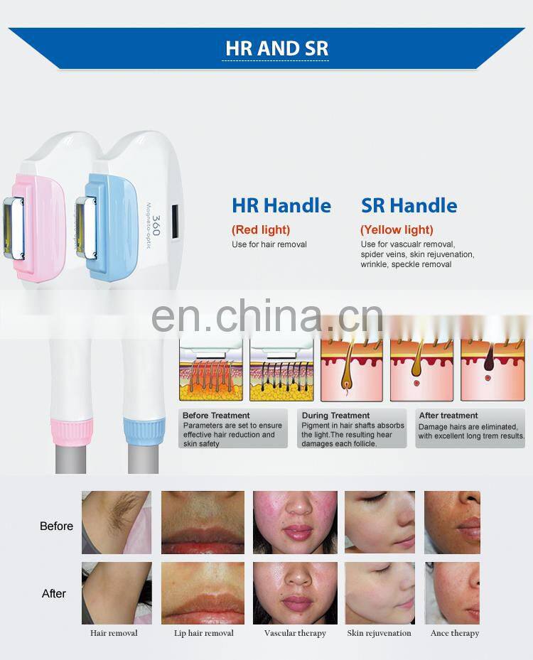 Double 360 Magneto-Optic Machine SHR Hair Removal Laser Tattoo Removal Machine