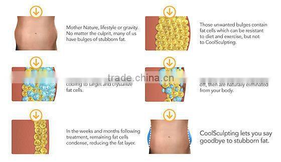 Top selling cryolipolysis cold body sculpting machine with vacuum massage