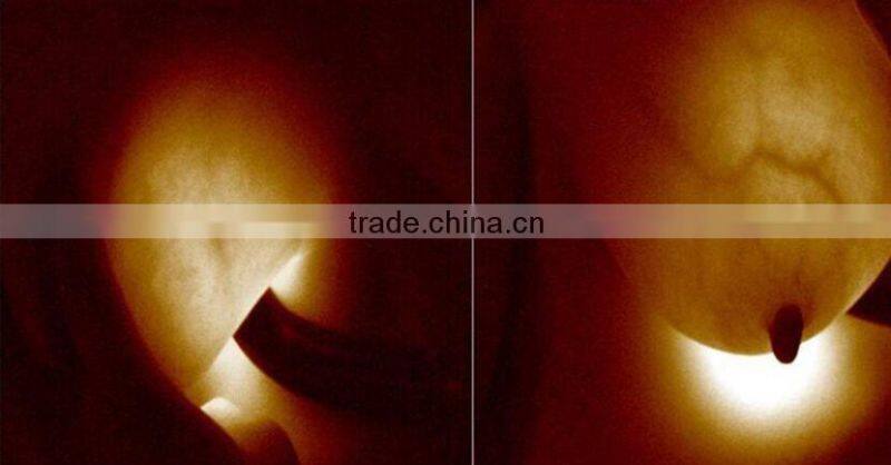 portable breast diagnostic tool breast analyzer and care with infrared