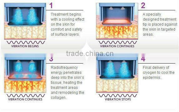 (CE Certificated) Non Surgical Mesotherapy Facial Firming Machine for Wrinkle Reduction&Fine Line Care R80
