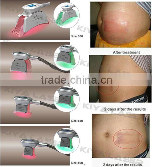 Promition price!hot!HOt! Hot! portable cryolipolyse slimming machine