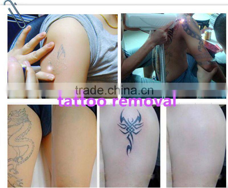 Shipping free portable q-switched laser price