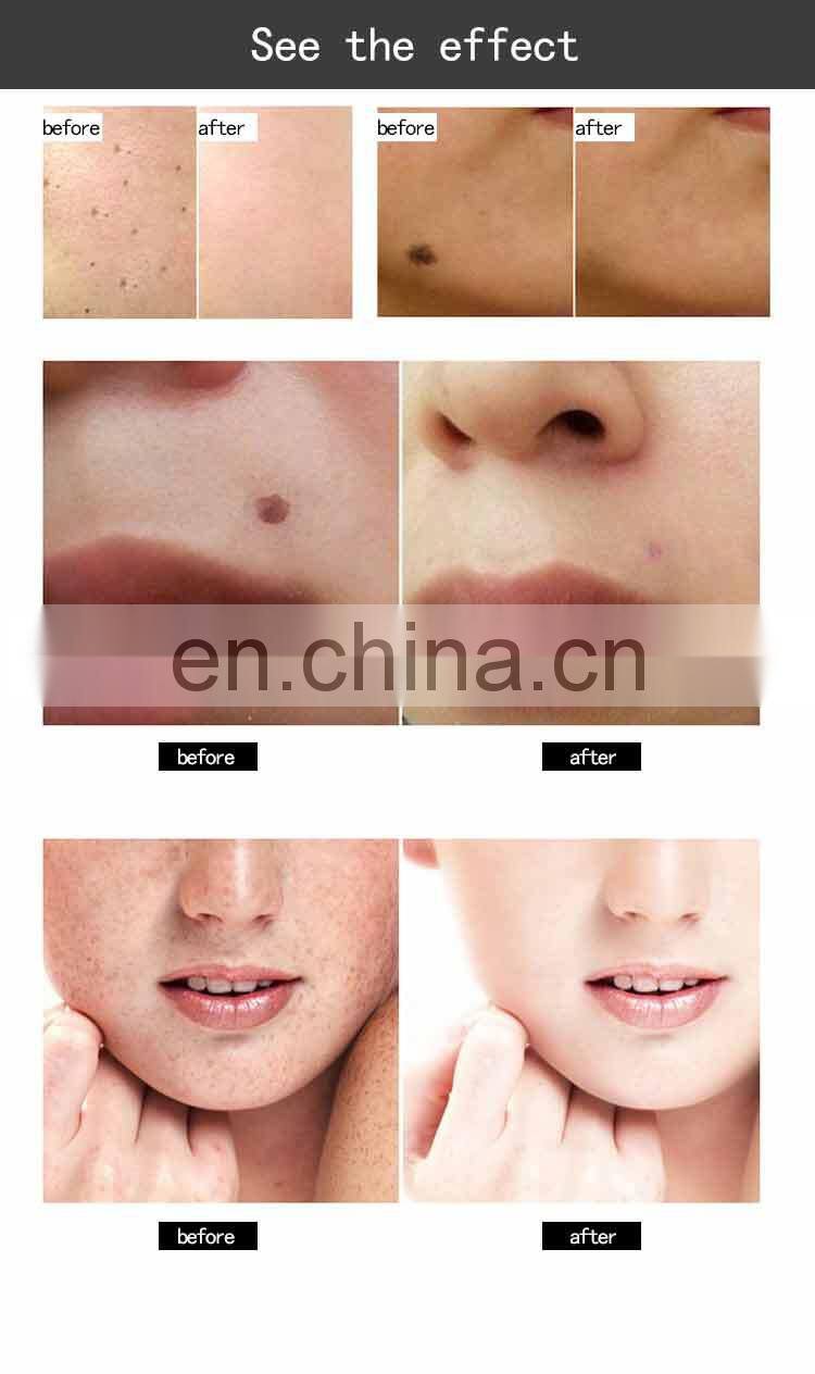 2019 Newest Ozone Plasma 2 In 1 Plasma Pen jett beauty instrument acne treatment ozone plasma pen with good price