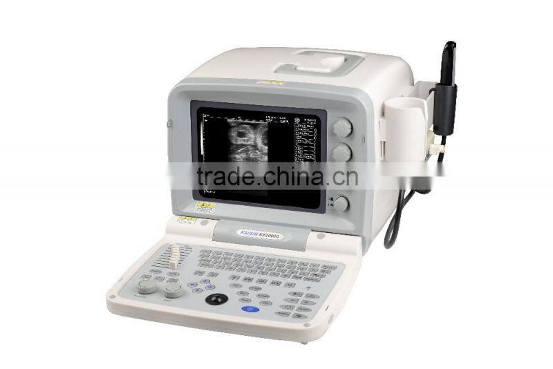 Hot Sale cheap And Best Seller Portable Ultrasound Machine 2000G