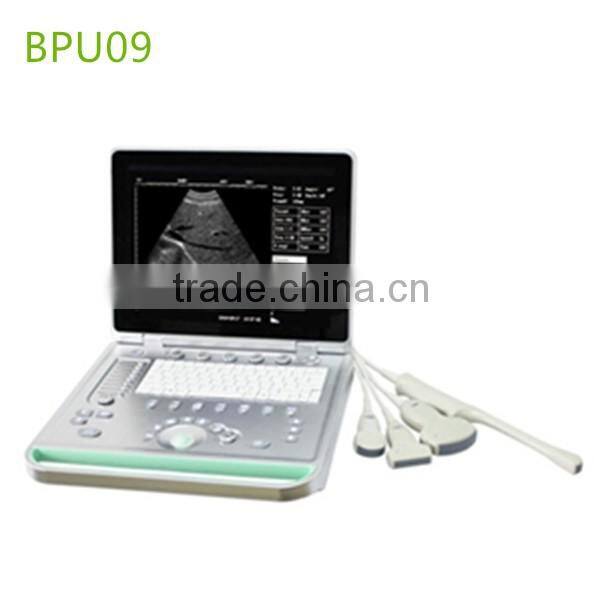 Portable Ultrasound Machine/Portable Ultrasound Scanner/Portable Ultrasound Manufacture Supplies- BPU09