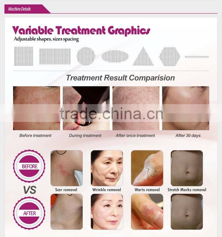 New arrival professional vagina tightening machine