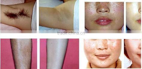 e-light RF IPL machine/ Laser ipl rf machine/ e-light rf beauty machine