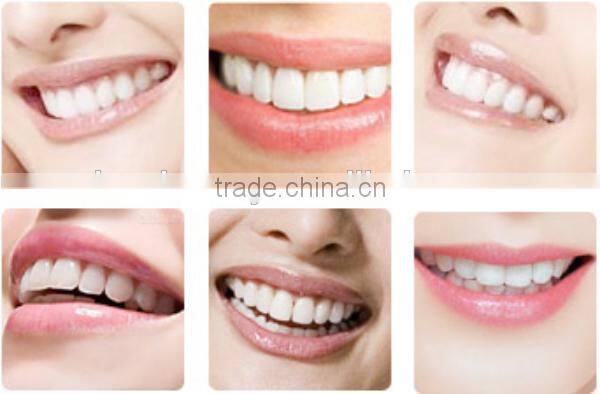 big sales promotion 6 pcs blue led lamps teeth whitening system dental equipment