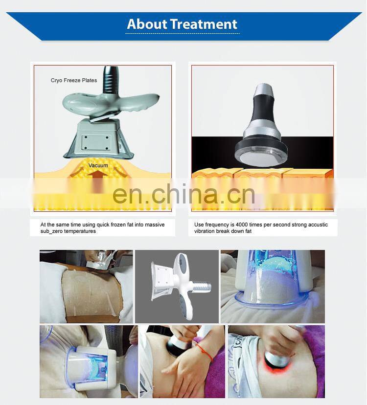 cryolipolysis 5 handles double chin reducer double chin massager