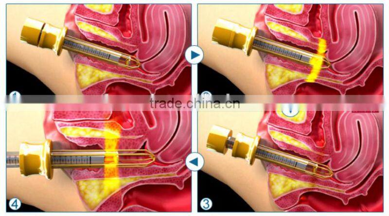 Golden Supplier Warts Cutting Skin Vaginal Tightening Co2 Fractional Laser