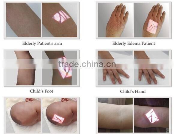 Hot Sale Hospital Venipuncture Use Vein Locator