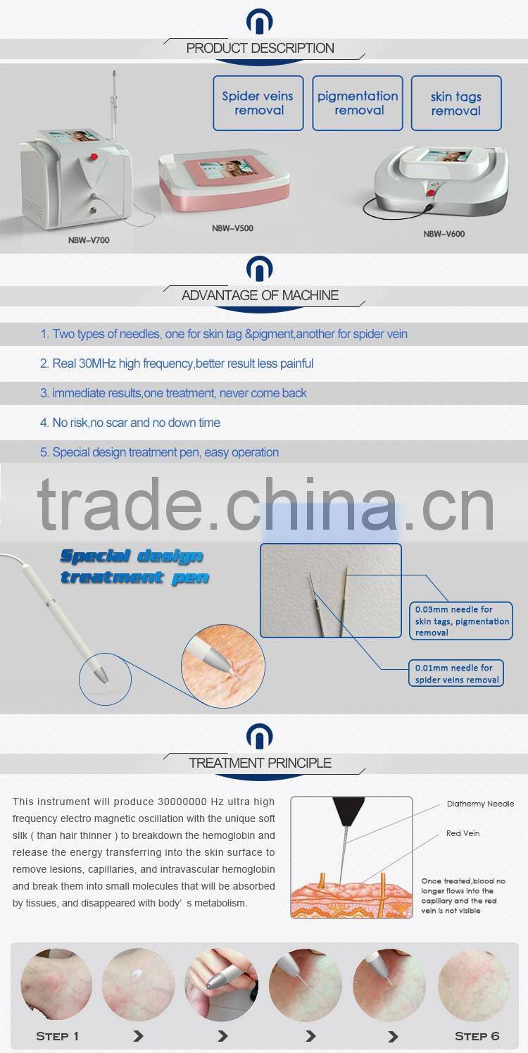30MHz high frequency spider vein removal machine laser vascular spider vein removal