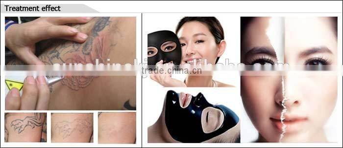 Hot selling CE TUV approved ml 2 in 1 elight+laser yb5