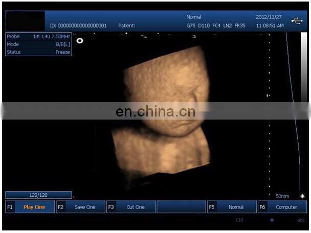 HC-A006A15 Inch Portable Black and White Ultrasound buy ultrasound scanner machines