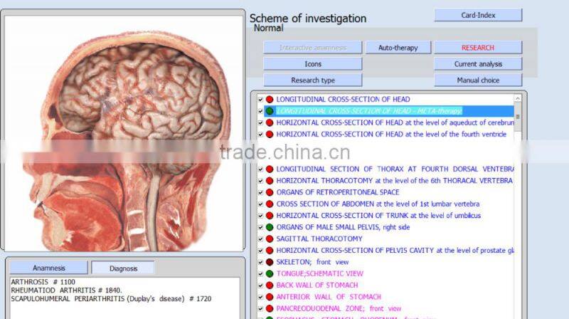 Professional 9DNLS health analyzer 9DNLS quantum magnetic analyzer for household