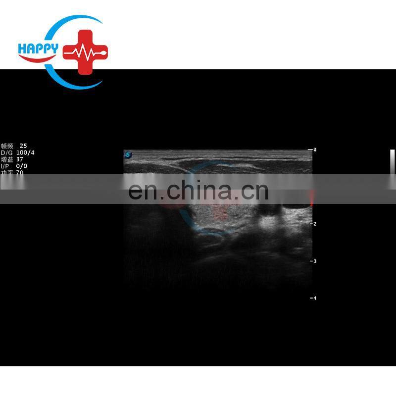 s22 cheap price color doppler sonoscape 4D ultrasound with fully-featured ultrasound system High Definition Image S22