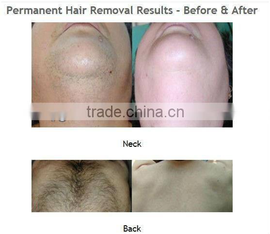 2014 newest factory price home use Mini IPL hair removal machine, CE approved