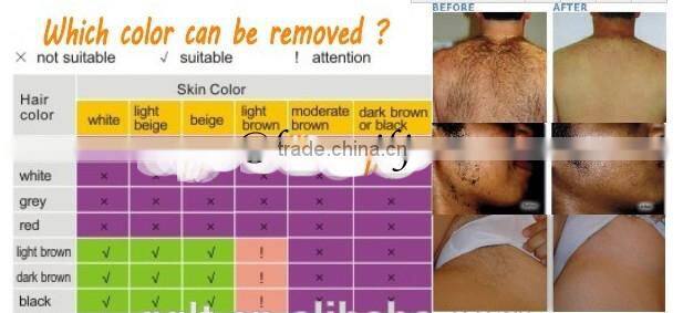 Newest Germany technology factory price 808 diode laser hair removal machine