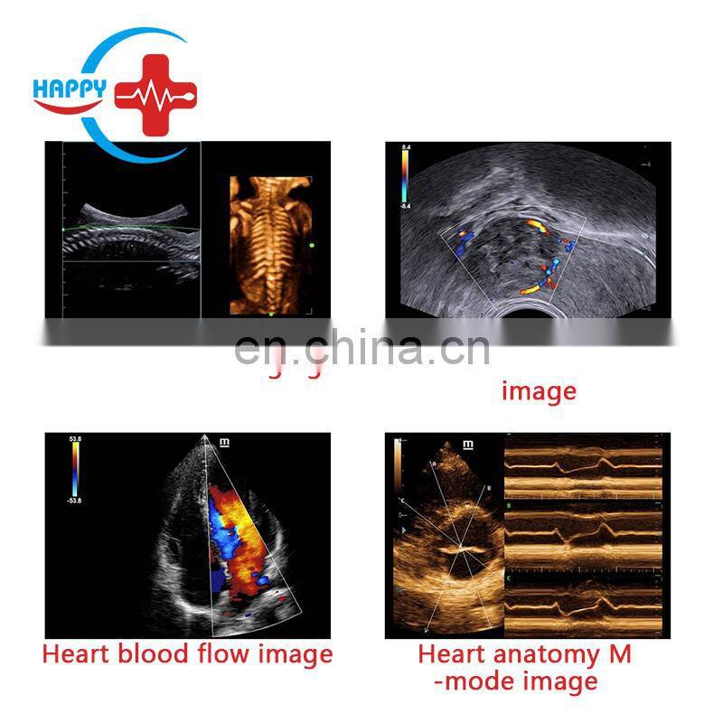 Best-selling Trolley Mindray dc-40 color doppler ultrasound machine portable Mindray ultrasound device