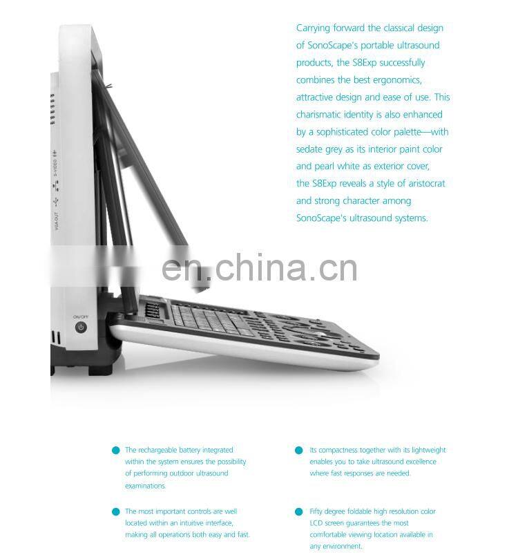 Professional 4D Color Doppler Sonoscape ultrasound scanner/Portable Sonoscape S8 EXP/Sonoscape ultrasound