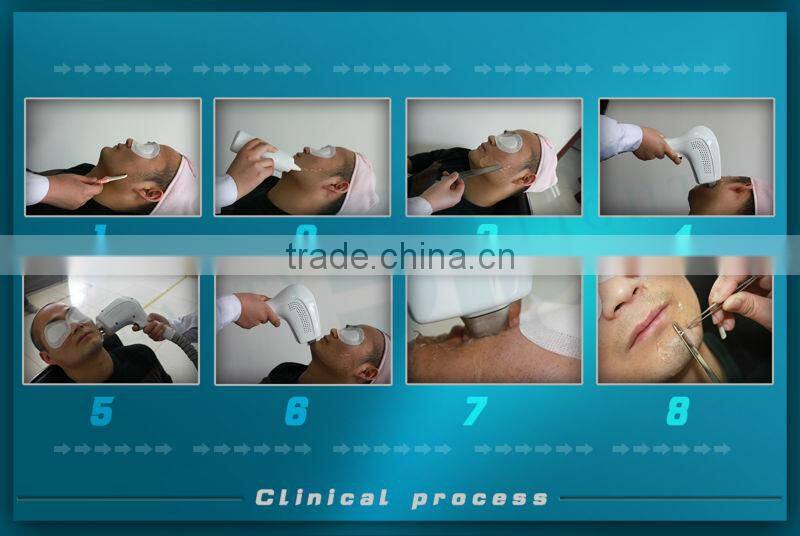 HR FHR SR diode aser hair removal system