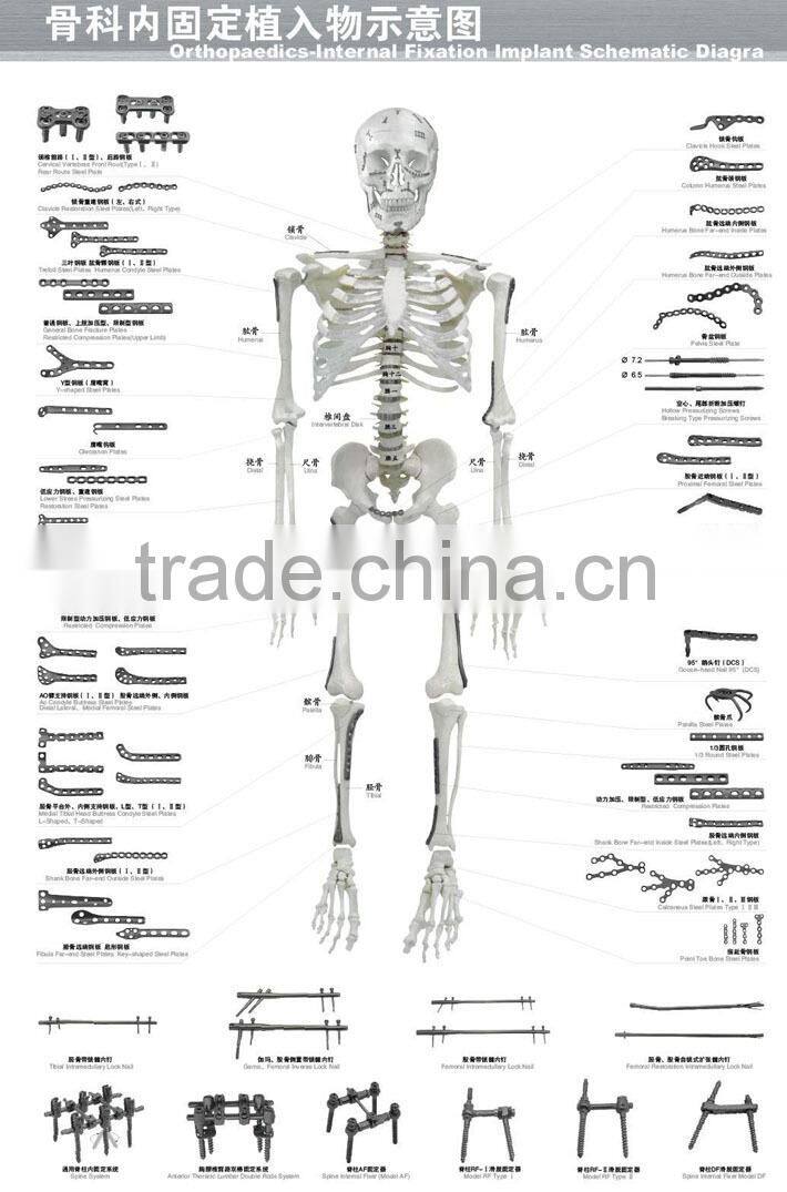 AF type external fixation surgical instruments Spinal fixator