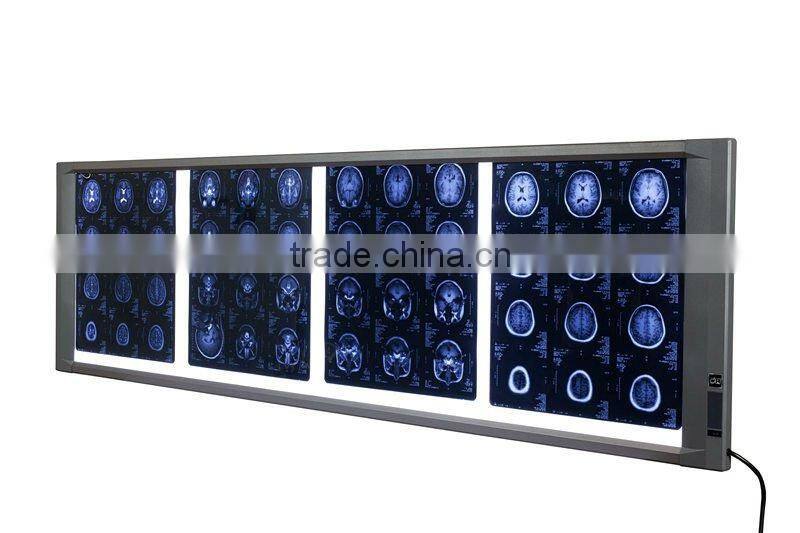 Digital x ray film reader