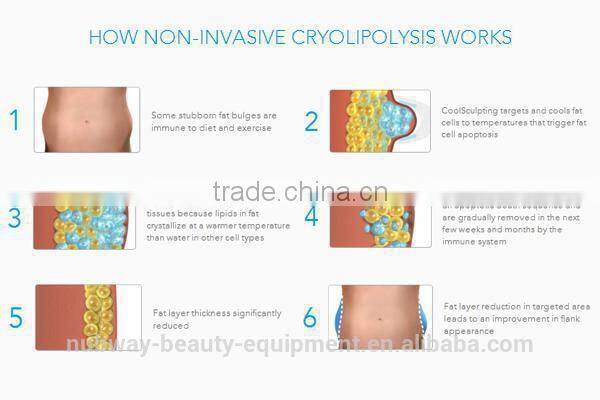 Multifunctional Vacuum Cavitation Slimming Machine With Comfortable Treatment