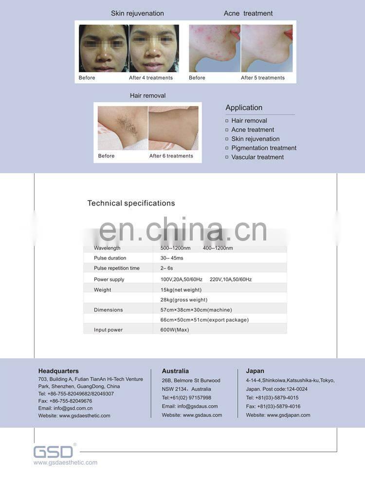 2015 TOP Sale IPL SHR Laser /Europe ipl shr laser/ 2 in 1 ipl shr device