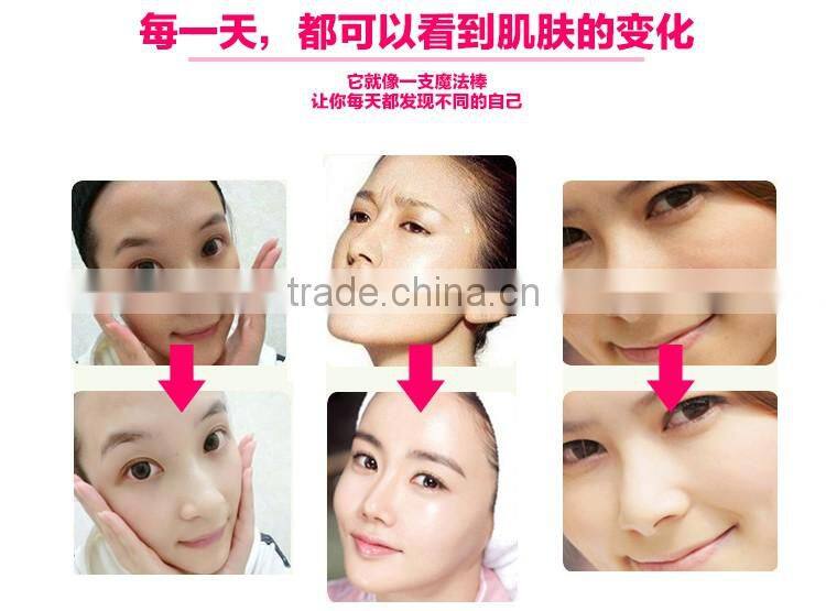 skinyang new design cheap mini body lifting skin tightening ultrasound ultra wave ems infrared skin care beauty devices