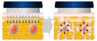 cavi lipo machine,Suitable for salon&home,cavitation&RF&vacuum&Laser 4 in 1,factory price