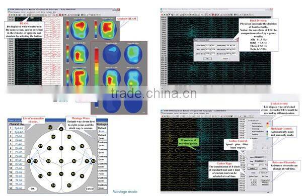 16 Channels multi-channels Digital EEG System for the patient KT88-1016