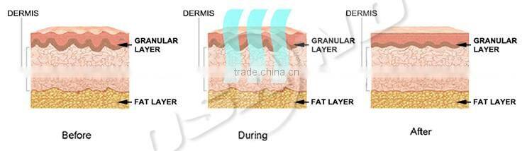 Amazing new release !!!RF facial care rf beauty machine portable