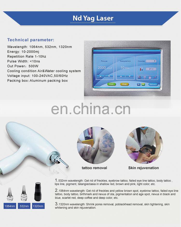 Europe best laser 1064 nm 532nm nd yag laser tattoo removal machine price