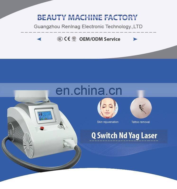 Our company want distributor! Factory direct sale nd yag laser q switch tattoo removal laser
