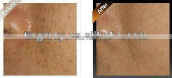 4 In 1 portable home beauty instrument suppliers tm-264