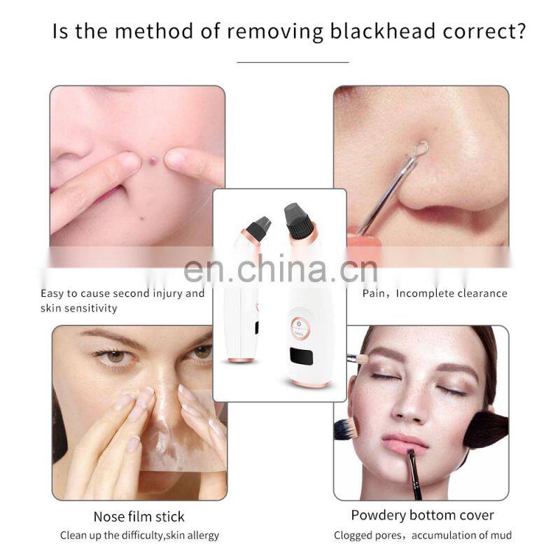 Newest blackhead acne extractor remover kit instrument